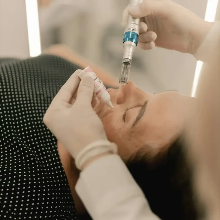 RF Microneedling