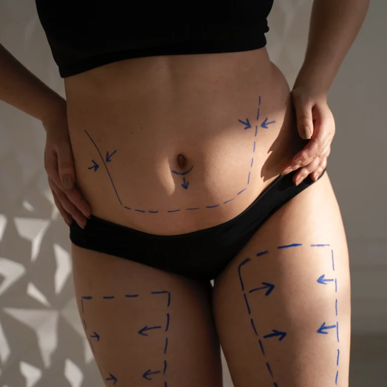 front-view-woman-s-body-with-marker-traces
