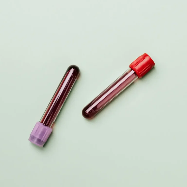 prp